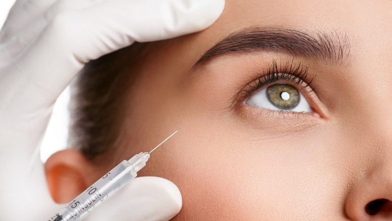 Top 5 questions about Botox answered. 